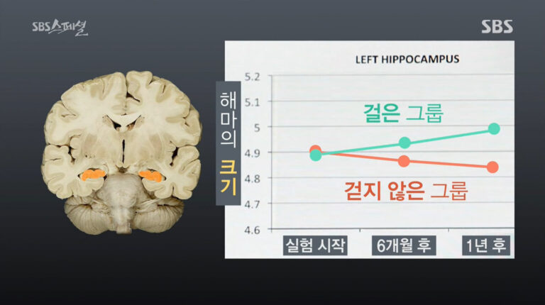 [건강 상식] 사람이 매일 걸어야 하는 이유